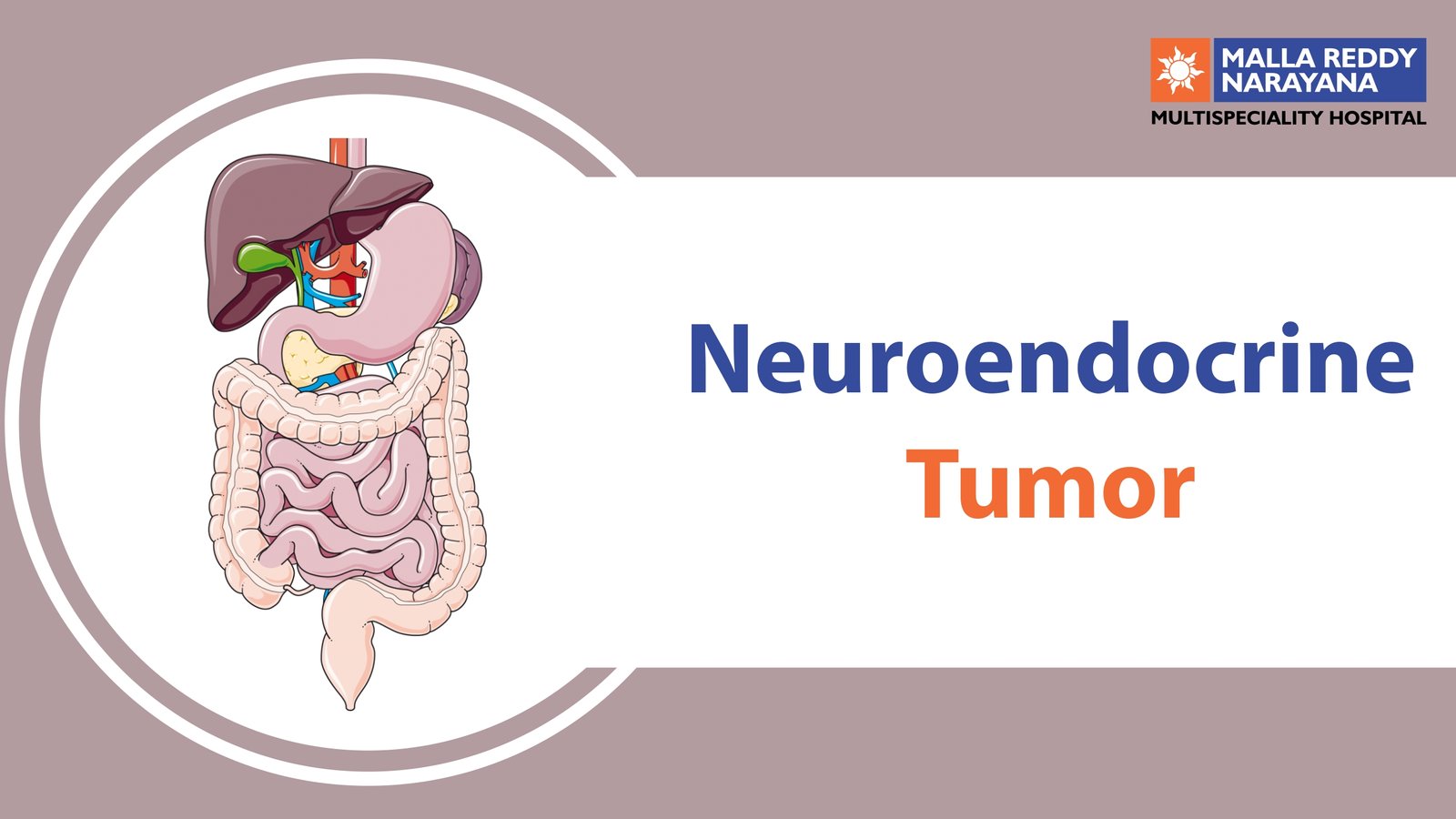Everything You Need To Know About Neuroendocrine Tumors & How To Be Safe