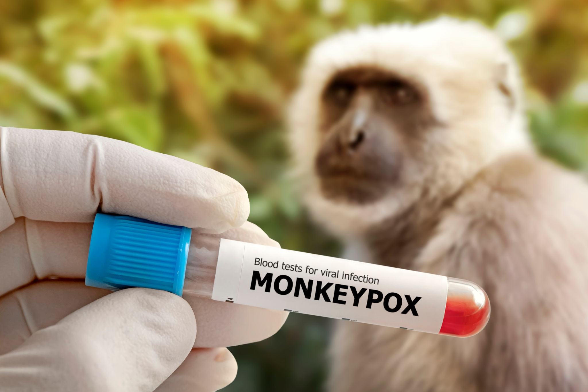 Is Monkeypox as contagious as COVID-19? The truth about Monkeypox, symptoms, causes & precautions to take.