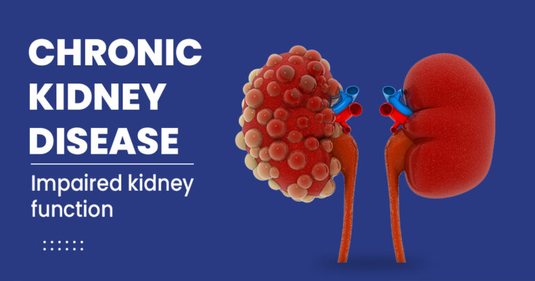 Understanding Chronic Kidney Disease (CKD): Causes, Symptoms, and ...